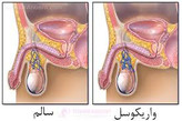 معجون واریکوسل وارداتی/طب سنتی هندی ایرانی با 30 گرم ژل رویال---یک کیلو