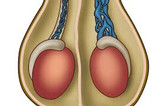 معجون واریکوسل وارداتی/طب سنتی هندی ایرانی با 30 گرم ژل رویال---یک کیلو