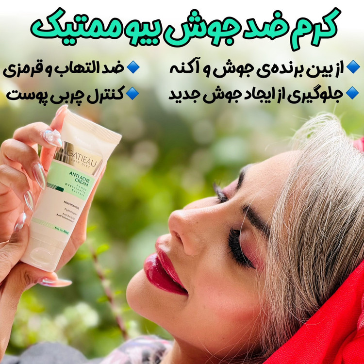 قویترین کرم ضد جوش و لک برند گاتیو ایتالیا اورجینال