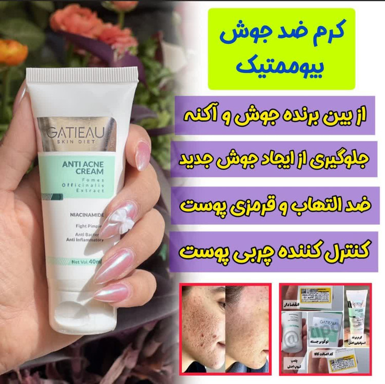قویترین کرم ضد جوش و لک برند گاتیو ایتالیا اورجینال
